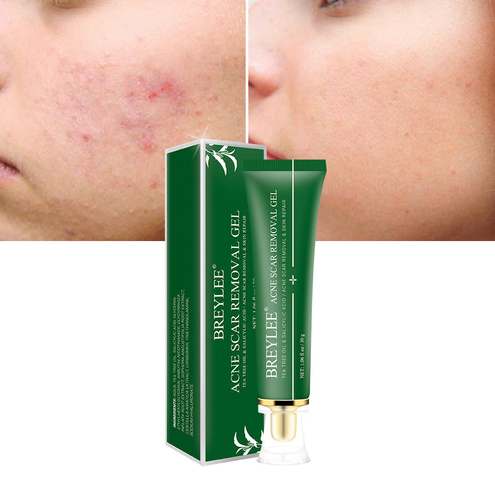 Korean Tea Tree Acne Scar Repair Gel