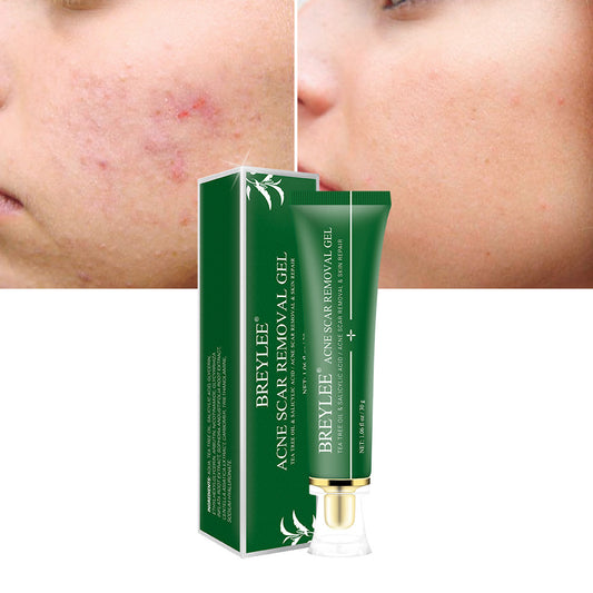 Korean Tea Tree Acne Scar Repair Gel